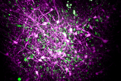 Roundish array of brain cells in magenta, green and white