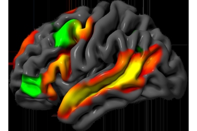 A 3D model of the human brain in grey, with different regions highlighted in red, green, and yellow.