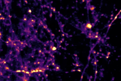 Over a tangle of dark blue neurons, bright orange spots appear along the lengths of some of the axons