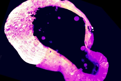 Micrograph of an organic-looking purple-and-white irregular loop