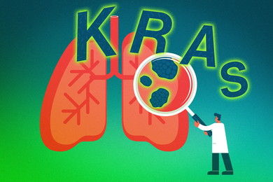 Big text says “KRAS” over a lung. A magnifying glass shows a tumor.