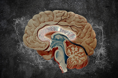 A brain illustration, with the striatum filled with lines from an atlas map 