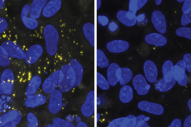 Two panels show blue cell nuclei on a black background. On the left, there are many more yellow speckles than on the right.