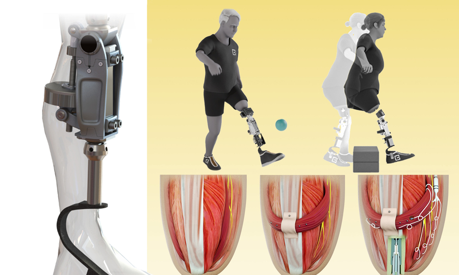 Renderings of the bionic knee, three steps to attaching the knee prosthetic, a person playing soccer with a prosthetic leg, and a person jumping over a box with prosthetic legs.