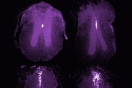 Coronal sections of injured adult spinal cord, anterior to posterior. The labelling shows recombined ependymal cells and their progeny (white) migrating out to the injury area in the dorsal funiculus, as a reponse to the injury (injury is in the image on the right hand corner). The mouse is a FoxJ1-CreER x R26R-LacZ reporter.