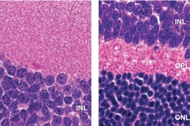 MIT researchers found that mice with normal DNA repair systems had more retinal degeneration upon exposure to environmental toxic agents than mice lacking a certain DNA repair system.  At right, the cross section of the retina from a mouse lacking the repair system is normal. At left, mice with too much DNA repair have greatly reduced numbers of cells in the OPL (outer plexiform layer) and ONL (ou...