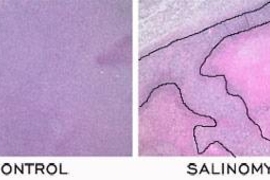 In a comparison of a control to the chemical identified by the Weinberg/Lander team, called salinomycin, the tumor cells (stained dark purple in both slides) were unaffected by the control, but salinomycin killed many tumor cells (stained pink).