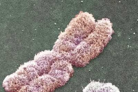 The Y chromosome, right, is dwarfed by the much larger X chromosome.