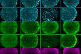 This image shows rows of human embryonic stem cells that MIT researchers grew on a new synthetic surface. The cells at top (blue) are stained to reveal their nuclei, while the cells in the middle and bottom are stained for proteins that are known to be present when cells are pluripotent.