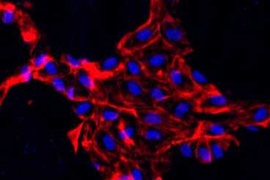 This fluorescent image shows endothelial cells embedded in a scaffold made of collagen. The cell nuclei are blue, and actin inside the cells shows up as red.