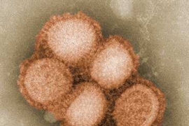 An image of the H1N1 influenza virus taken in the CDC Influenza Laboratory.