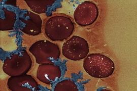 A colorized electron micrograph of red blood cells with gold nanorods (yellow dots) on their surfaces. The blue represents a fixing polymer.