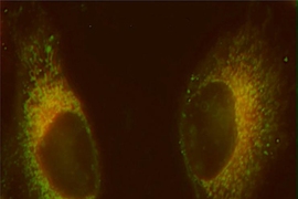 In these cells, mitochondria are labeled with a red fluorescent dye, and the platinum compound targeted to the mitochondria is labeled green. Areas where the two colors overlap, forming yellow, highlight the accumulation of platinum in the mitochondria.