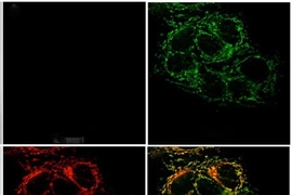 Fluorescence microscopy images of live cervical cancer cells pretreated with the sensor: (Top left) minimal fluorescence, reflecting low levels of mobile zinc ions; (top right) a bright green signal appears once zinc ions are taken into the cell; (bottom left) the red fluorescence signal indicating the location of mitochondria; (bottom right) an overlay of the zinc sensor signal and mitochondrial ...