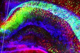 colorized image of brain tissue
