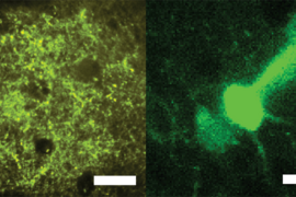Two side-by-side micrographs of neurons