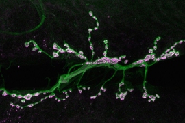 Individual neurons mix multiple RNA edits of key synapse protein, study  finds, MIT News