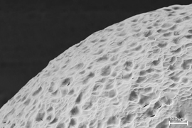 A stealth material surface, shown here, has been engineered to provide an “invisibility cloak” against the body’s immune system cells. In this electron microscopy image, you can see the material's surface topography.