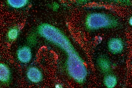 This image demonstrates tissue patterns that emerge from genetically programmed human pluripotent stem cells, and was taken on day nine of the MIT study. It shows immunostainings of cell nuclei for CEBPA (red, endodermal marker), SOX10 (green, ectodermal marker), and DAPI (blue, binds to DNA in the nucleus).