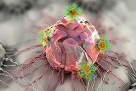 Researchers at MIT are developing an adhesive patch that can stick to a tumor site, either before or after surgery. The patch delivers a triple-combination of drug, gene, and photo (light-based) therapy via specially designed nanospheres and nanorods, shown here attacking a tumor cell.