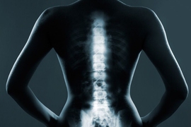 Researchers designed and tested several types of optical sensors that could be placed at the tip of an epidural needle and determined that the best is one that relies on Raman spectroscopy. This technique, which uses light to measure energy shifts in molecular vibrations, offers detailed information about the chemical composition of tissue.