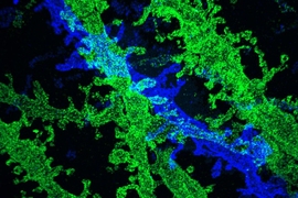 By expanding brain tissue twice, researchers were able to obtain high-resolution images of neurons in the hippocampus.