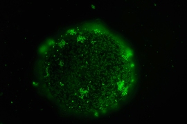 Marine bacteria form a community on a nutrient particle in the Cordero Lab.