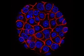 This image shows pancreatic cancer cells (nuclei in blue) growing as a sphere encased in membranes (red).