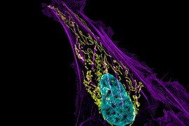 This osteosarcoma cell appears with DNA in blue, mitochondria in yellow, and actin filaments in purple.