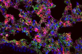 New nanoparticles can perform gene editing in the lungs, MIT News