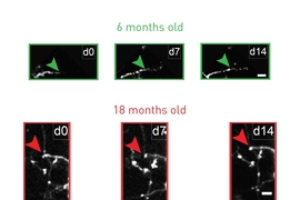 Tracking the growth of neuron arbors under the microscope over two weeks, researchers typically saw growth beyond the arrow marker in 6-month-old mice (green), but none beyond the marker in 18-month old mice (red).
