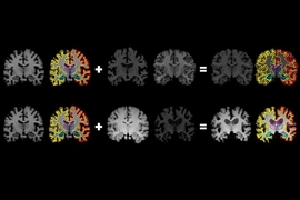 research papers on medical image processing MIT researchers have developed a system that gleans far more labeled training data from unlabeled data, which could help machine-learning models better detect structural patterns in brain scans associated with neurological diseases. The system learns structural and appearance variations in unlabeled scans, and uses that information to shape and mold one labeled scan into thousands of new, distinct...
