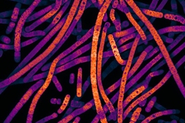 Fluorescent micrograph of the cyanobacteria Scytonema hofmanni