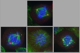 Top: A cell undergoing normal cell division (mitosis). Bottom row: Defects in the mitotic spindle produced by two drugs that interfere with cancer cell division. These defects can lead to cell death.