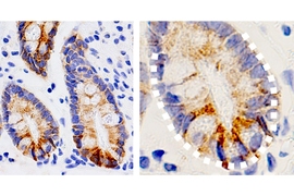 MIT biologists found that intestinal stem cells express high levels of a ketogenic enzyme called HMGCS2, shown in brown.