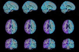 With their model, researchers were able to generate on-demand brain scan templates of various ages (pictured) that can be used in medical-image analysis to guide disease diagnosis. 