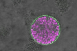 Experiments identified one gene, which the researchers named Bradyzoite-Formation Deficient 1 (BFD1), as the only gene both sufficient and necessary to prevent the transition from tachyzoite to bradyzoite stages of T. gondii infection. The findings may inform research into potential therapies for toxoplasmosis, or even a vaccine.