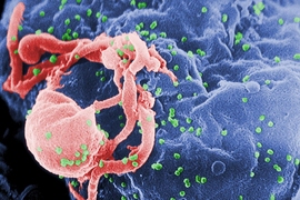 Scanning electron micrograph of HIV-1 (in green) budding from a cultured lymphocyte