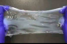 A new technology called ELAST transforms tissues, such as this slab of human brain, to make them reversibly stretchable or compressible, as well as much more durable. This allows them to be repeatedly stretched out or squished down thin for much faster infusion of labeling probes, which labs use to highlight cells or molecules under the microscope.