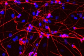 Immunofluorescence microscopy of MeCP2 neurons derived from mouse embryonic stem cells