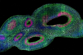 A 2D micrograph of an oblong organoid on a black background features thousands of spots of many different colors. There are also two large open spaces within the shape.
