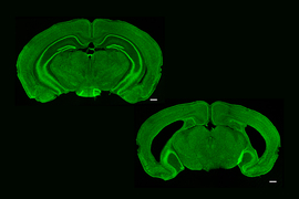 Over a black background are two oval-shaped, green-stained mouse brain cross-sections. The lower-right one has big crescent-shaped holes on either side.