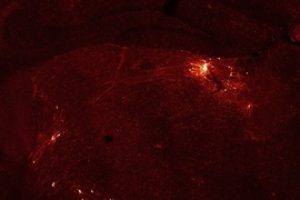Isolated clusters of neurons glows yellow-orange over a dark background