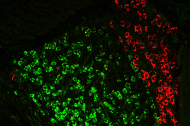 anteroventral thalamus