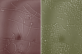 the yeast Candida albicans and mucin glycans