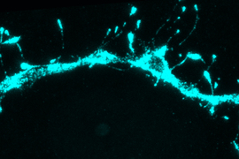 A thick thread-like synapse appears as a light blue line on a black background, with thin threads emerging on top.