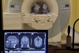Control-room view of a person in an MRI machine. In the foreground on the bottom left is a monitor showing three views inside the person's brain.