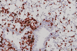 On a grey background sits brown and purple particles with red circles around the brown spots.