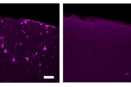 Two panels show a section of mouse brain tissue with a dull magenta glow over a black background. In the left panel many neurons are lit up brightly in magenta. In the right panel only one neuron is lit up brightly.