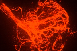 On a black background, a cable of bright red tubes comes into the frame from the upper left. The tubes quickly fan out into a big tangled ball in the center of the image.